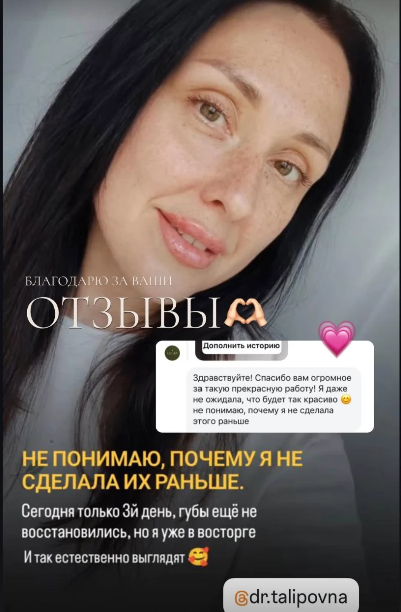 Отзыв: губы выглядят естественно